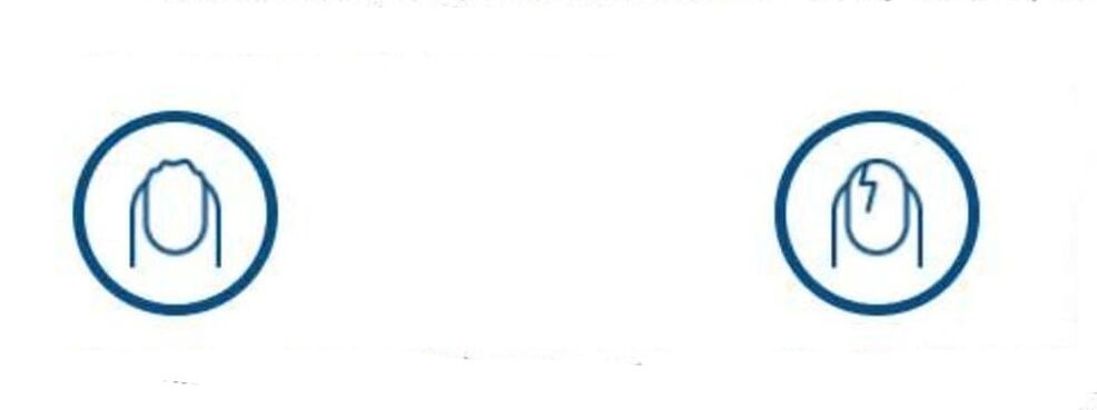 deformacja paznokci z powodu infekcji grzybiczej